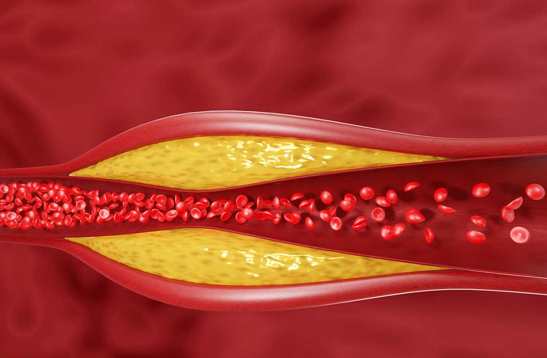 How Is Cholesterol Produced?