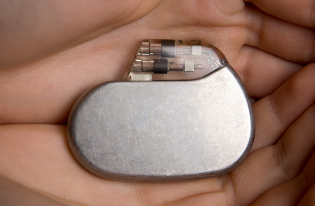 What Is a Pacemaker?