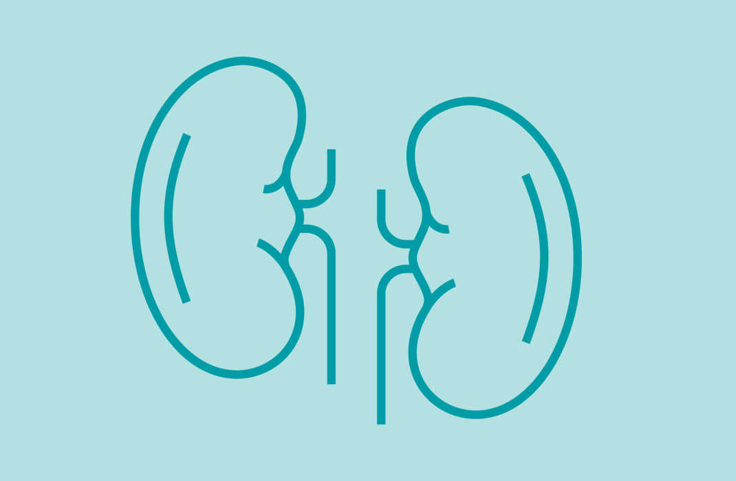 Mass General Brigham Researchers Develop Urine Test to Detect Kidney Transplant Rejection