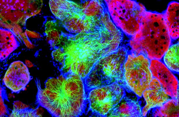 Cancer-Preventing Topical Immunotherapy Trains the Immune System to Fight Precancers