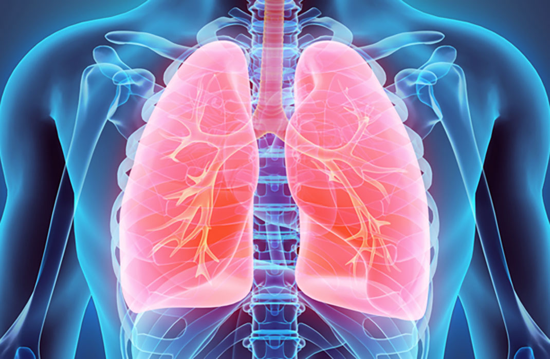 Research Spotlight: AI-Enabled Body Composition Analysis Predicts Outcomes for Patients with Lung Cancer Treated with Immunotherapy
