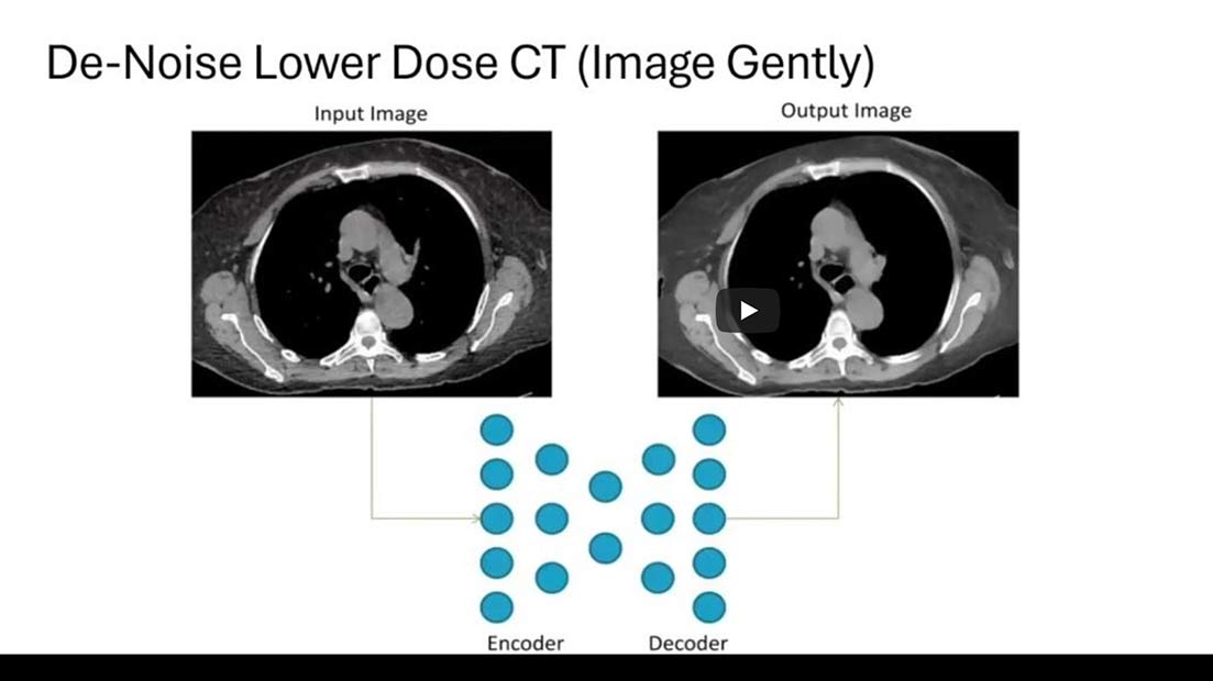 Side-by-side versions of the same CT scan, illustrating the effects of image cleanup.