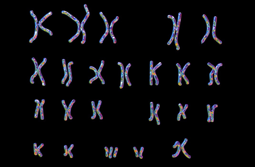 The chromosomes of someone with Trisomy 21
