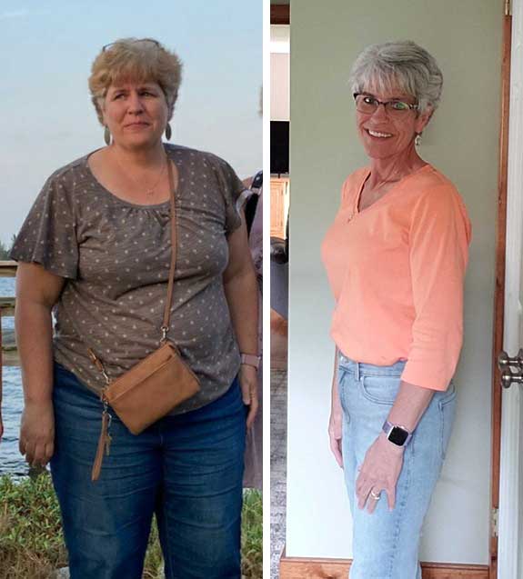 Mary Fournier in 2022, before bariatric surgery, looking heavy, and in 2023, after surgery, looking thin.