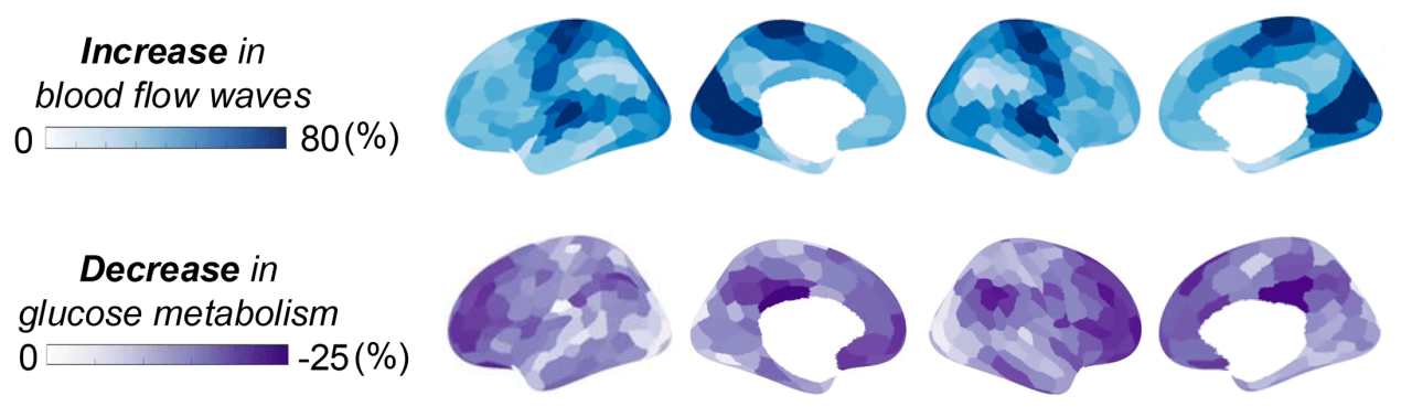 Graphic showing brain-wide changes in blood flow waves and glucose metabolism during NREM sleep