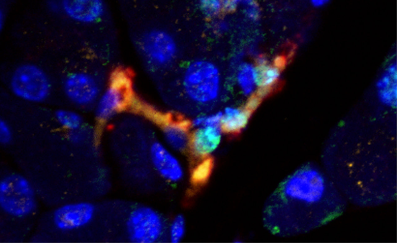 Image of pancreatic cancer cells